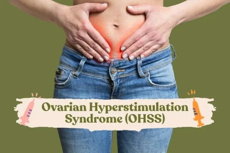 OHSS Ovarian Hyperstimulation Syndrome Bocah Indonesia