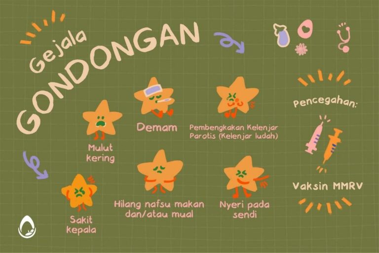 Gejala gondongan dan pencegahannya