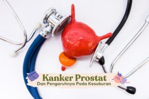 Kanker Prostat