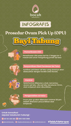 OPU Bayi tabung