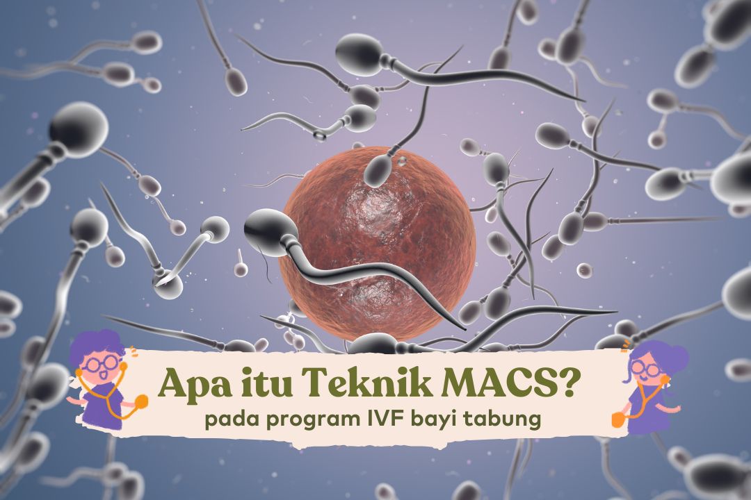 Magnetic Activated Cell Sorting Sperm (MACS) pada Teknologi Reproduksi Berbantu