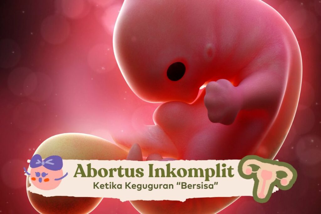 Incomplete abortion: Spontaneous Termination of Pregnancy