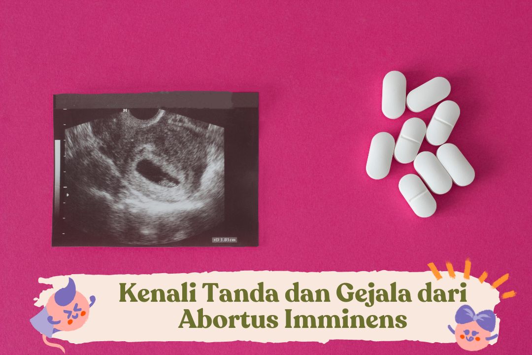 Kenali Tanda dan Gejala dari Abortus Imminens