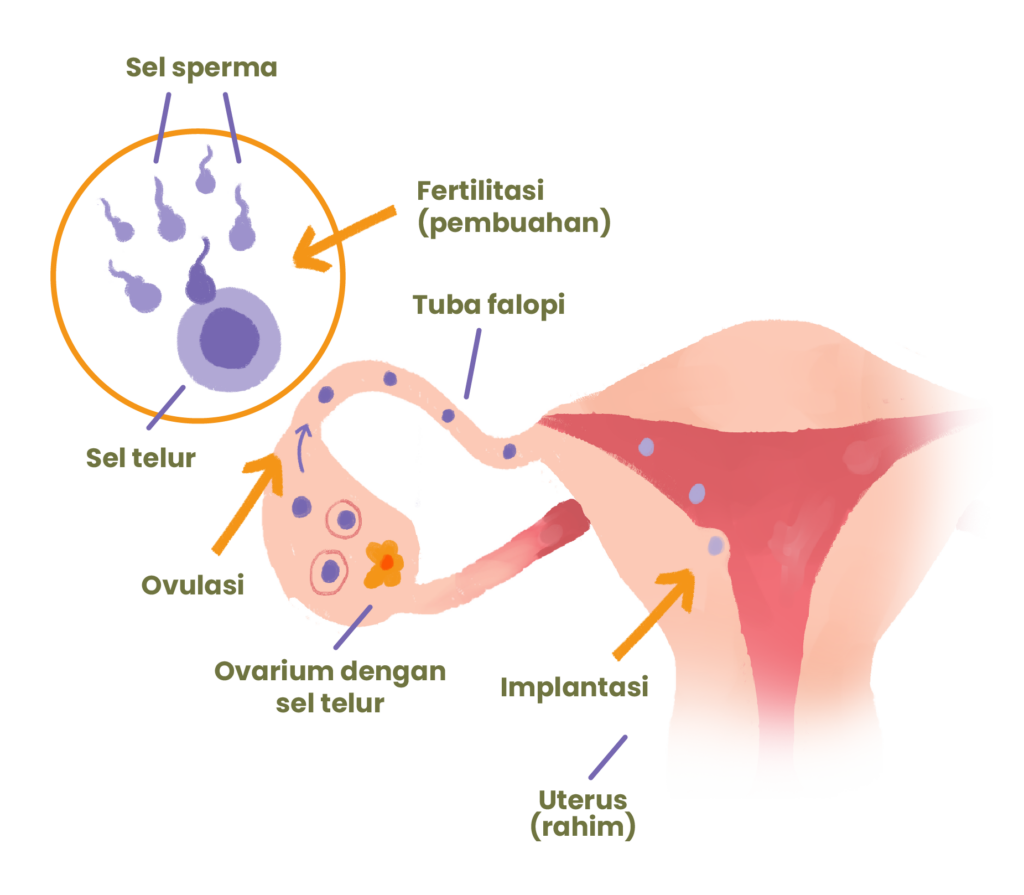 Penyebab infertilitas pada wanita