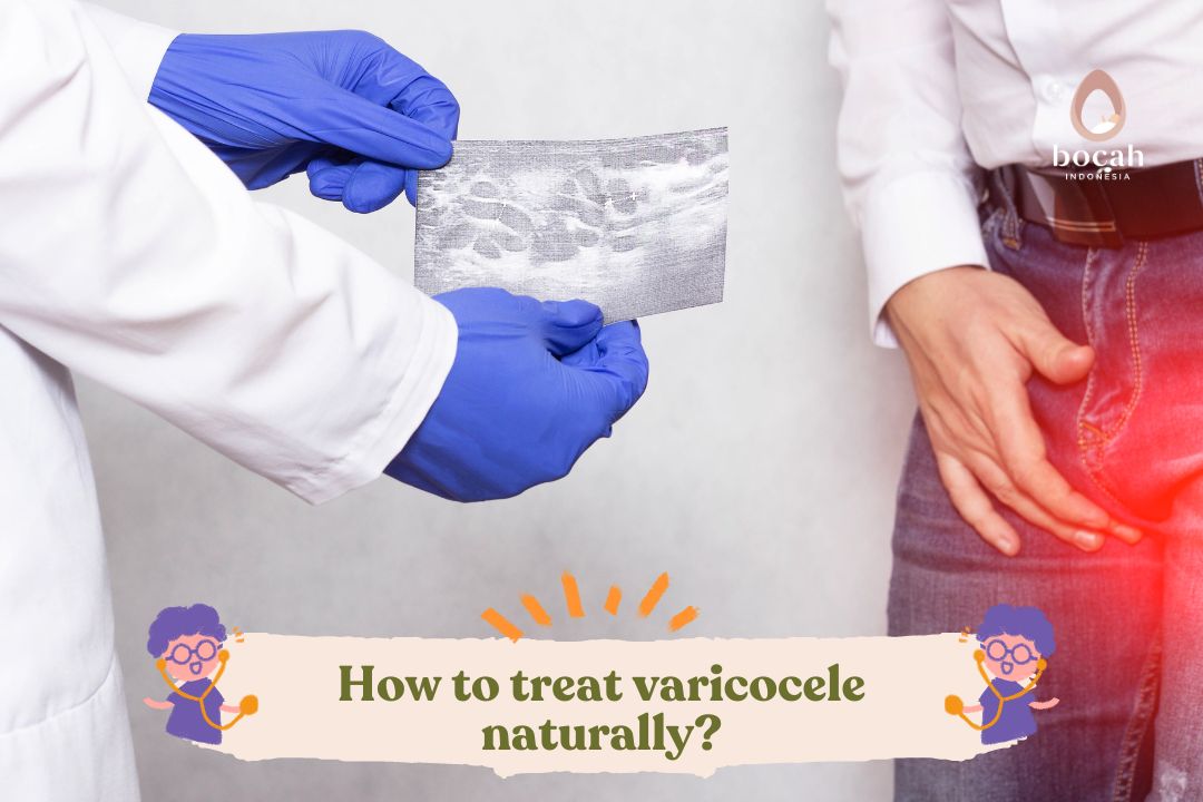 How to treat varicocele naturally?