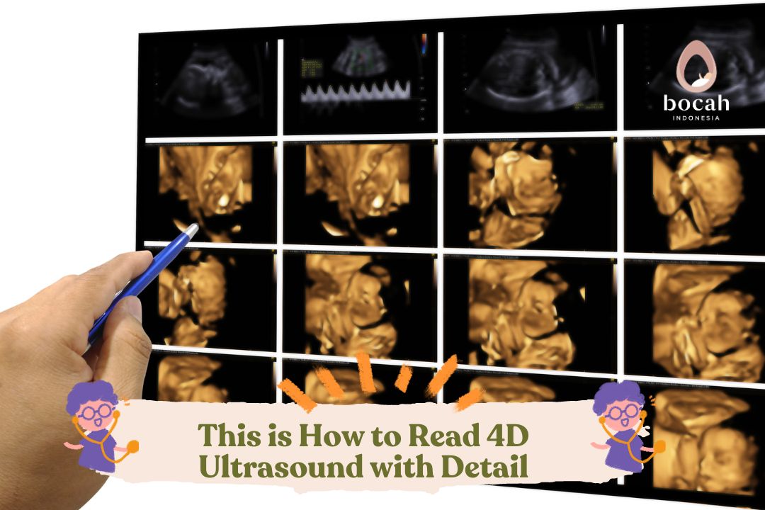 Pregnant Moms, This is How to Read 4D Ultrasound with Detail