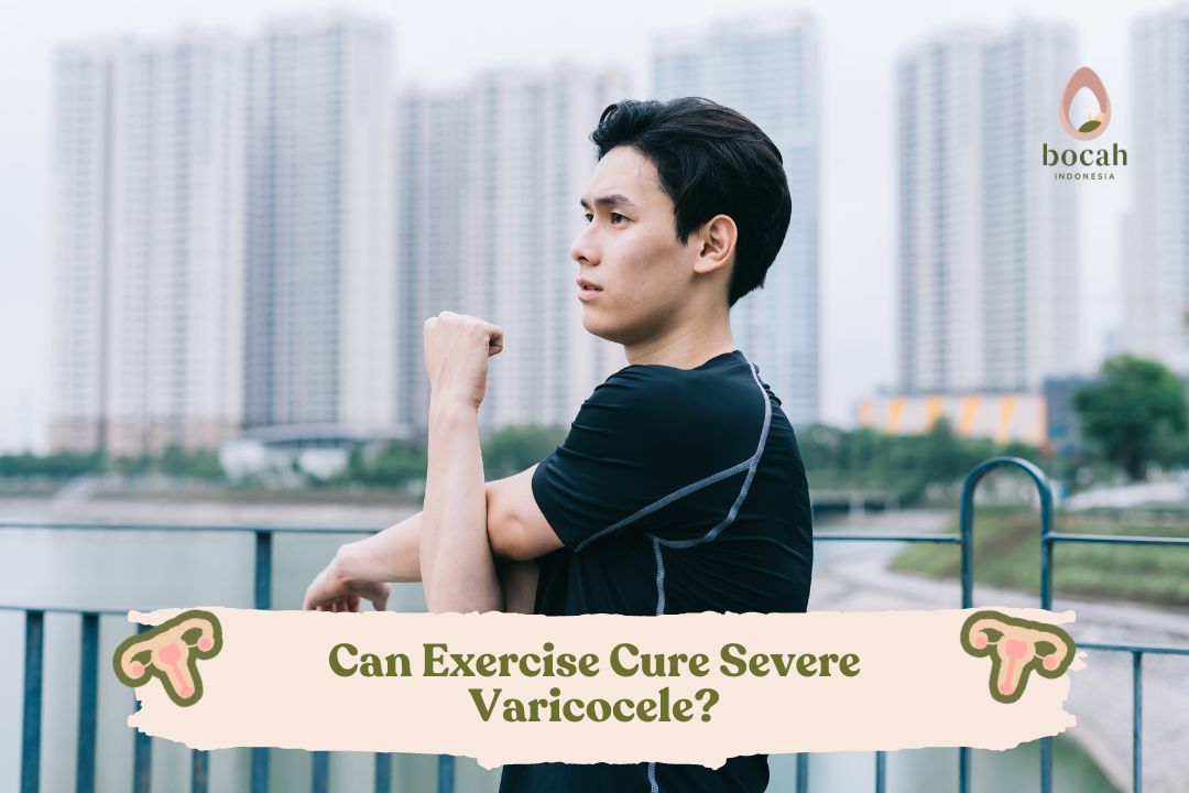 Can Exercise Cure Varicocele?