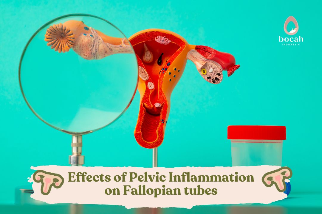 Effects of Pelvic Inflammation on Fallopian tubes