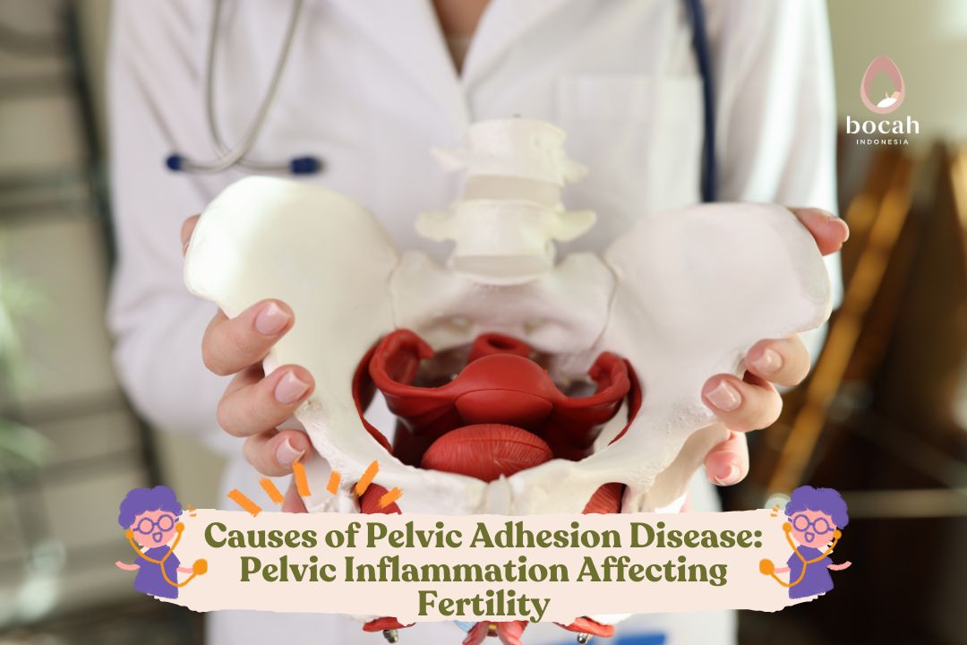 Causes of Pelvic Adhesion Disease: Pelvic Inflammation