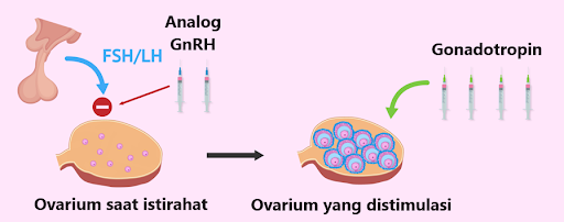 How the Ovarian Stimulation Protocol Works