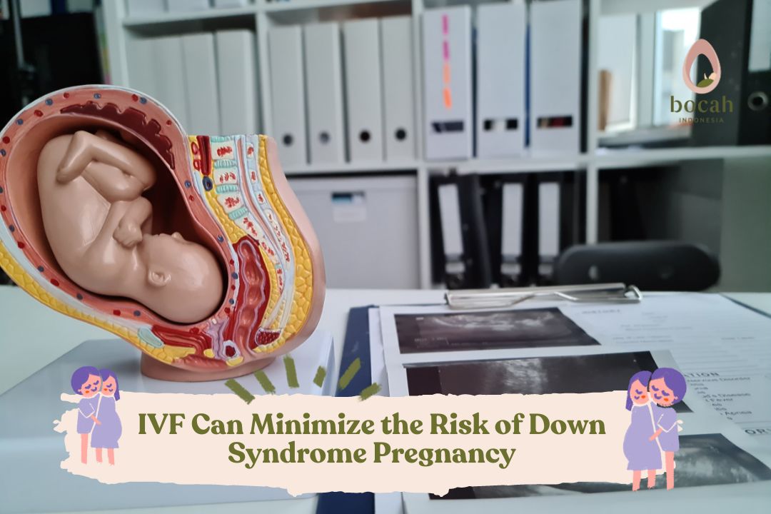 IVF Can Minimize the Risk of Down Syndrome Pregnancy