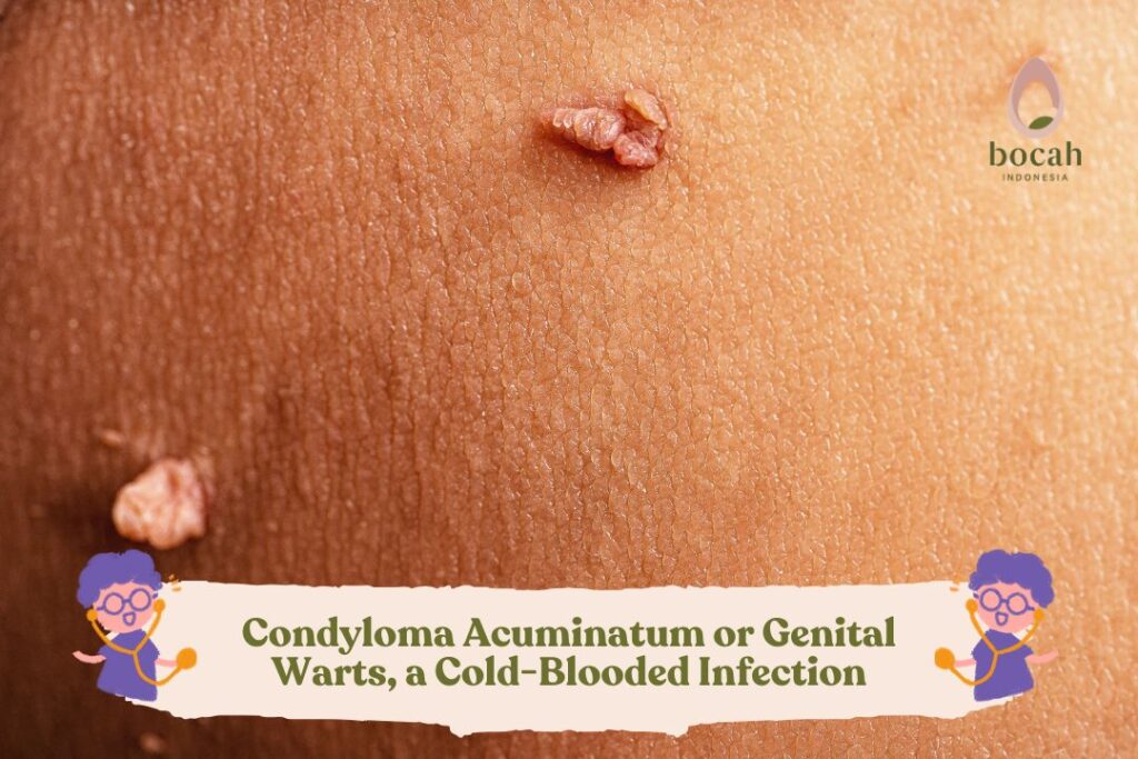 Condyloma Acuminatum or Genital Warts, a Cold-Blooded Infection