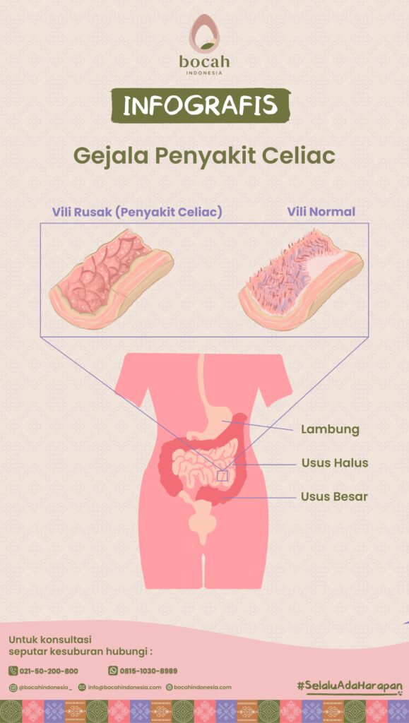 Penyakit celiac