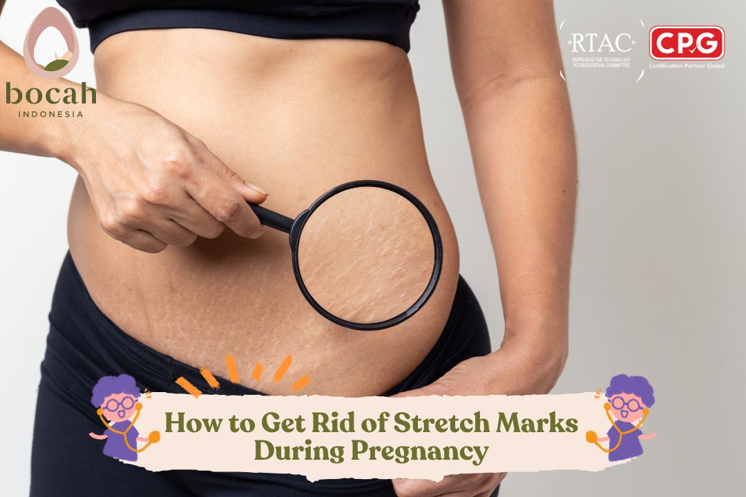 How to Get Rid of Stretch Marks During Pregnancy