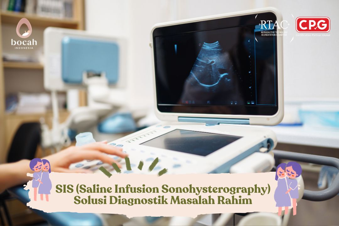 Sonohisterografi (SIS): Prosedur Aman untuk Deteksi Kelainan Rahim