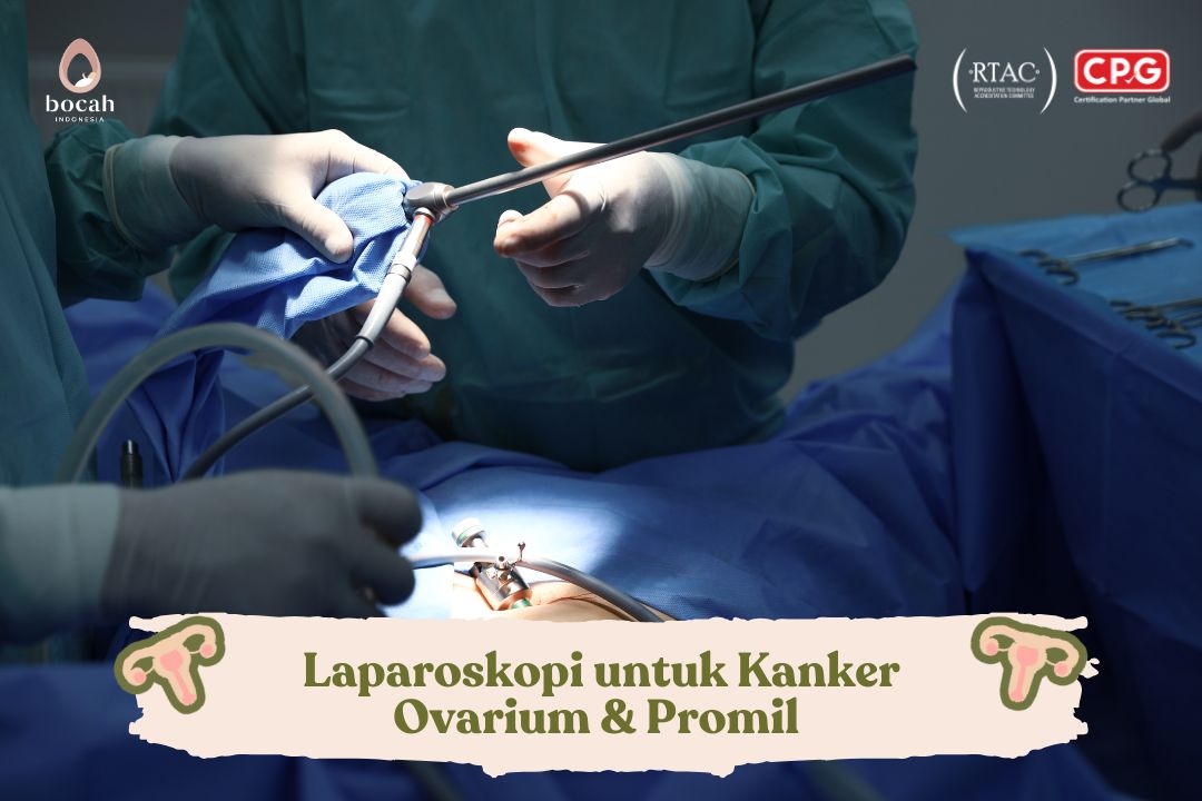 Laparoskopi untuk Deteksi Kanker Ovarium dan Mendukung Program Hamil