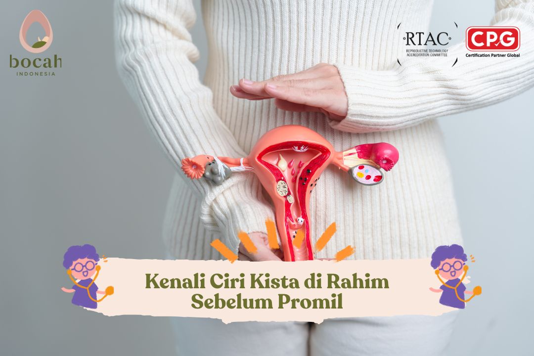 Kenali Ciri Kista di Rahim Sebelum Promil